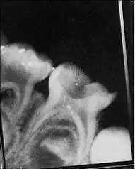 关于儿童“霉神经”，你需要知道的知识！