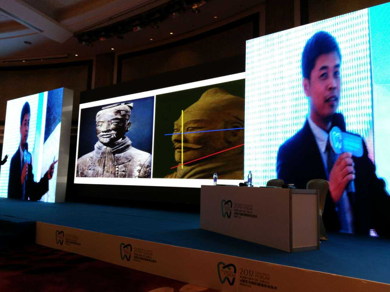 金作林教授——从兵马俑引伸面部形象美