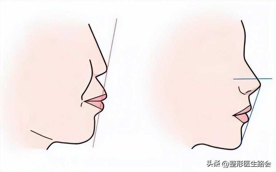 不得不承认，凸嘴对一个人的颜值影响还是蛮大的！（老路说真相）