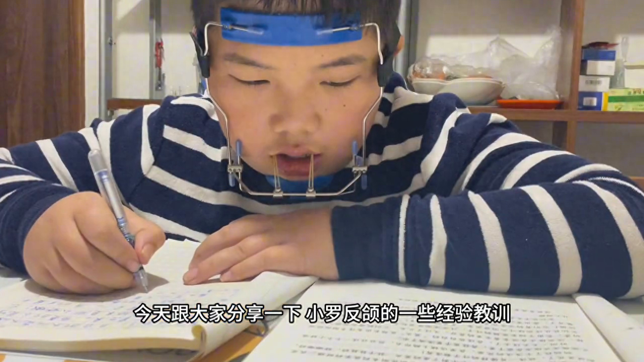 反颌矫正#反颌矫正