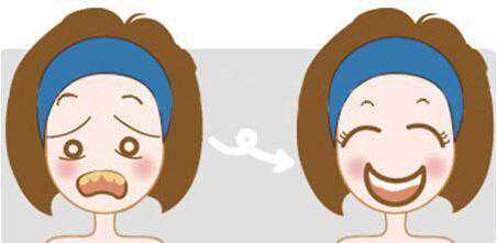 四环素牙牙齿美白保养，看一看你是几环素牙