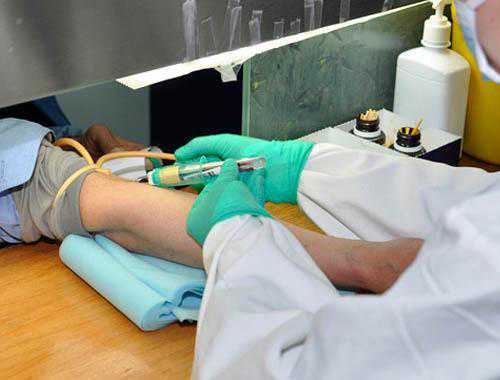 洗牙前要查血吗？洗牙一次多少钱？疼不疼？