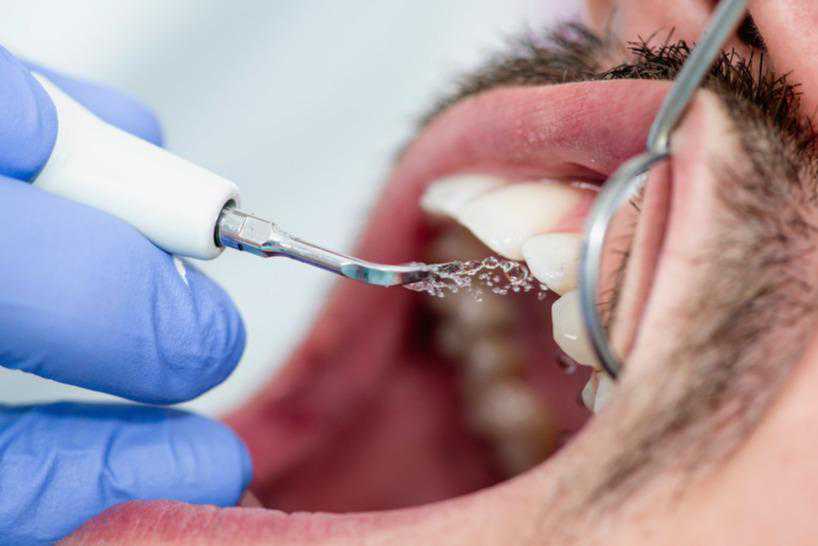 护齿7步走，扫荡"牙菌斑"让牙齿健康不再沦陷