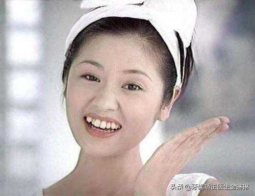 长了虎牙怎么处理？长了虎牙可以直接拔除吗？