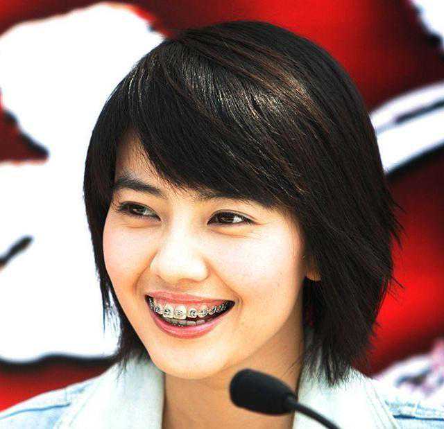 明星整牙惨痛事实：不但不能整容，还会毁了牙齿